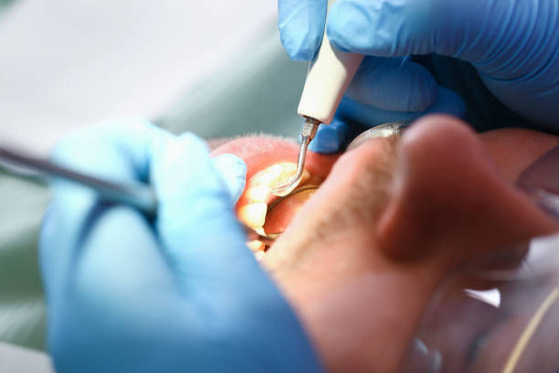 Best Orthodontic Emergency Dentist in Rushville, IN