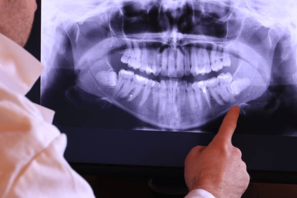 Best Emergency Cosmetic Dentistry in Rushville, IN