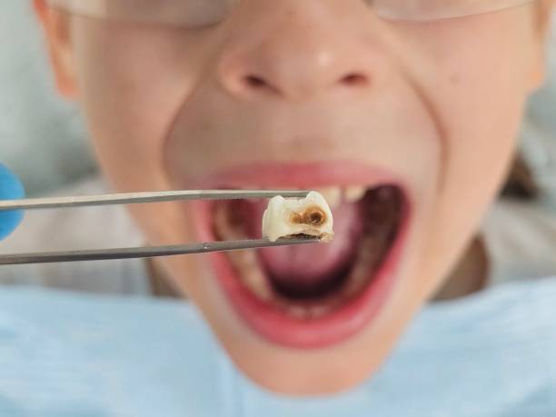 Best Holiday Emergency Dentist in Rushville, IN