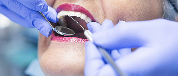 Best Emergency Dental Services for Seniors in Rushville, IN